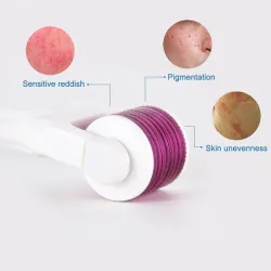 Elektrische micronaald met LED - titanium dermaroller - antirimpel - verjongende gezichts- / lichaamsmassage-apparaatMassage