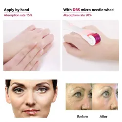 Elektrische micronaald met LED - titanium dermaroller - antirimpel - verjongende gezichts- / lichaamsmassage-apparaatMassage