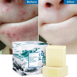 Honey Soap - Goat Milk - Remove Acne - - Clean Skin - Blackhead RemoverHuid