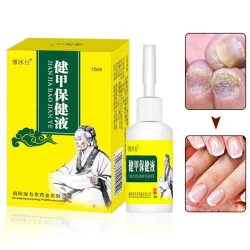 15ml - nagel schimmel behandeling - verwijderen - nagels reparatie vloeistofBehandeling