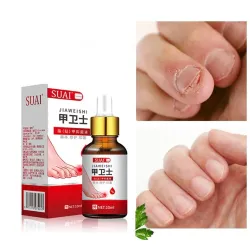 Gel voor het verwijderen van schimmelnagels - serum - anti-infectie / paronychia / onychomycose - 10mlBehandeling