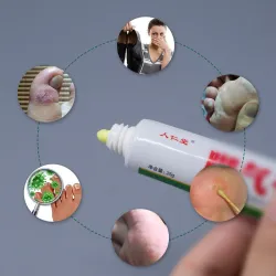 Voetcrème - anti-jeuk - anti-zweet - anti-geur - voetpsoriasis - pijnstilling - antibacteriële zalfVoeten
