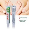 Voetcrème - anti-jeuk - anti-zweet - anti-geur - voetpsoriasis - pijnstilling - antibacteriële zalfVoeten