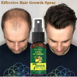 Ginger care hair growth essence spray – nourish roots, repair damage & revitalize scalp for stronger, healthier hairHair