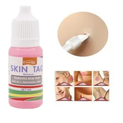 Skin tag removal - voetwratten - medische vloeistof - 10ml - 2 stuksHuid
