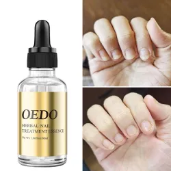 Schimmelnagelbehandeling - etherische olieBehandeling