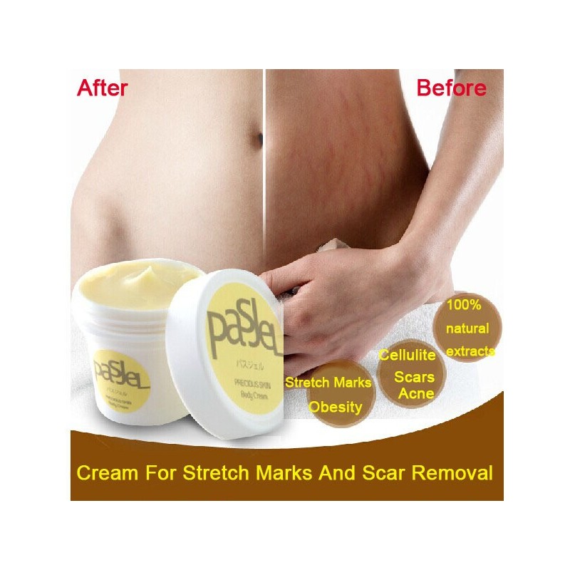Stretch marks & scars removal creamMassage