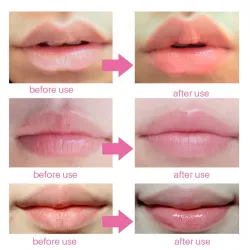 Kristal collageen lipmasker - hydraterende - anti-rimpelpleistersLippenstiften